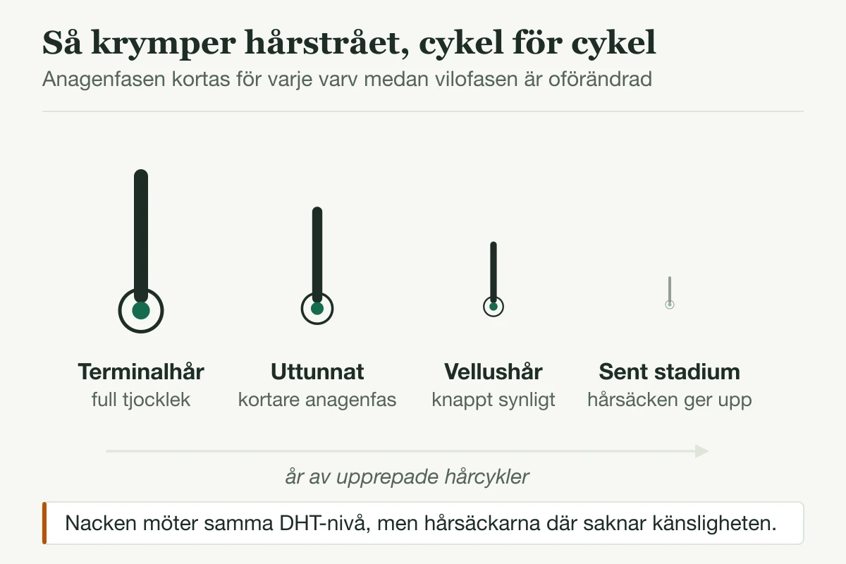 Fyra allt tunnare hårstrån som visar hur hårsäcken miniatyriseras till vellushår